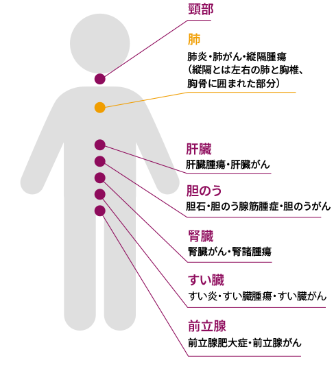 男性の体形イラスト