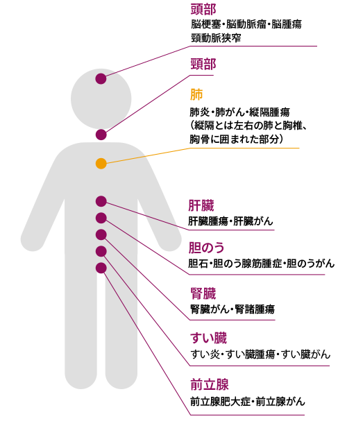男性の体形イラスト