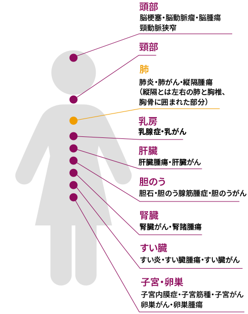 女性の体形イラスト